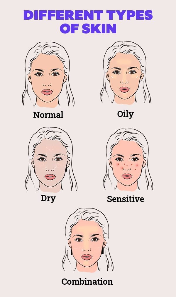 Skin types